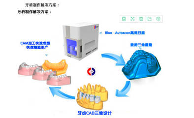 牙齒三維掃描儀 重塑口腔醫(yī)療與技術(shù)服務(wù)新體驗(yàn)